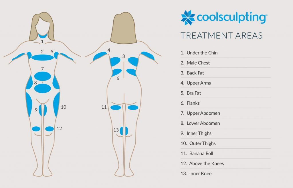 chart demonstrating places on the body where coolscupting can be performed