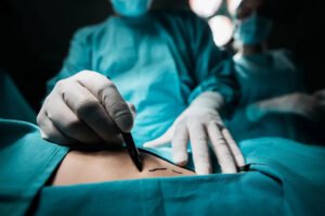 Plastic surgeon marking up patient